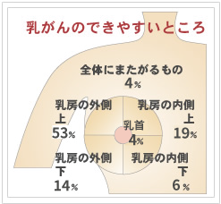 乳がんのできやすいところ図