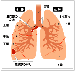 肺の構造図