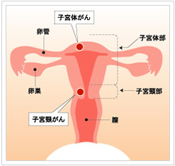子宮 子宮の病気のはなし | まりこレディスクリニック - 静岡県静岡市 ...